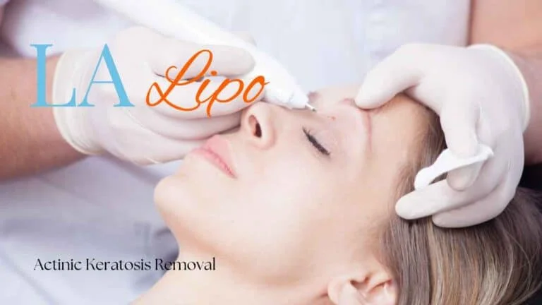 Woman receiving Actinic Keratosis Removal Treatment Wokingham