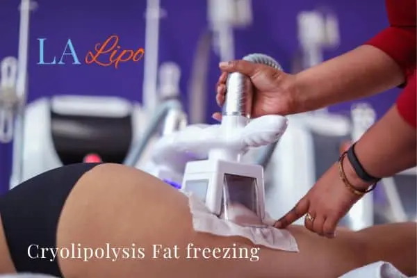 women getting fat freezing Wokingham