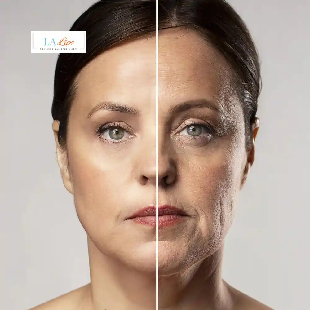 How Can You Tell If Non-Surgical Skin Tightening Is Right for You Wokingham?