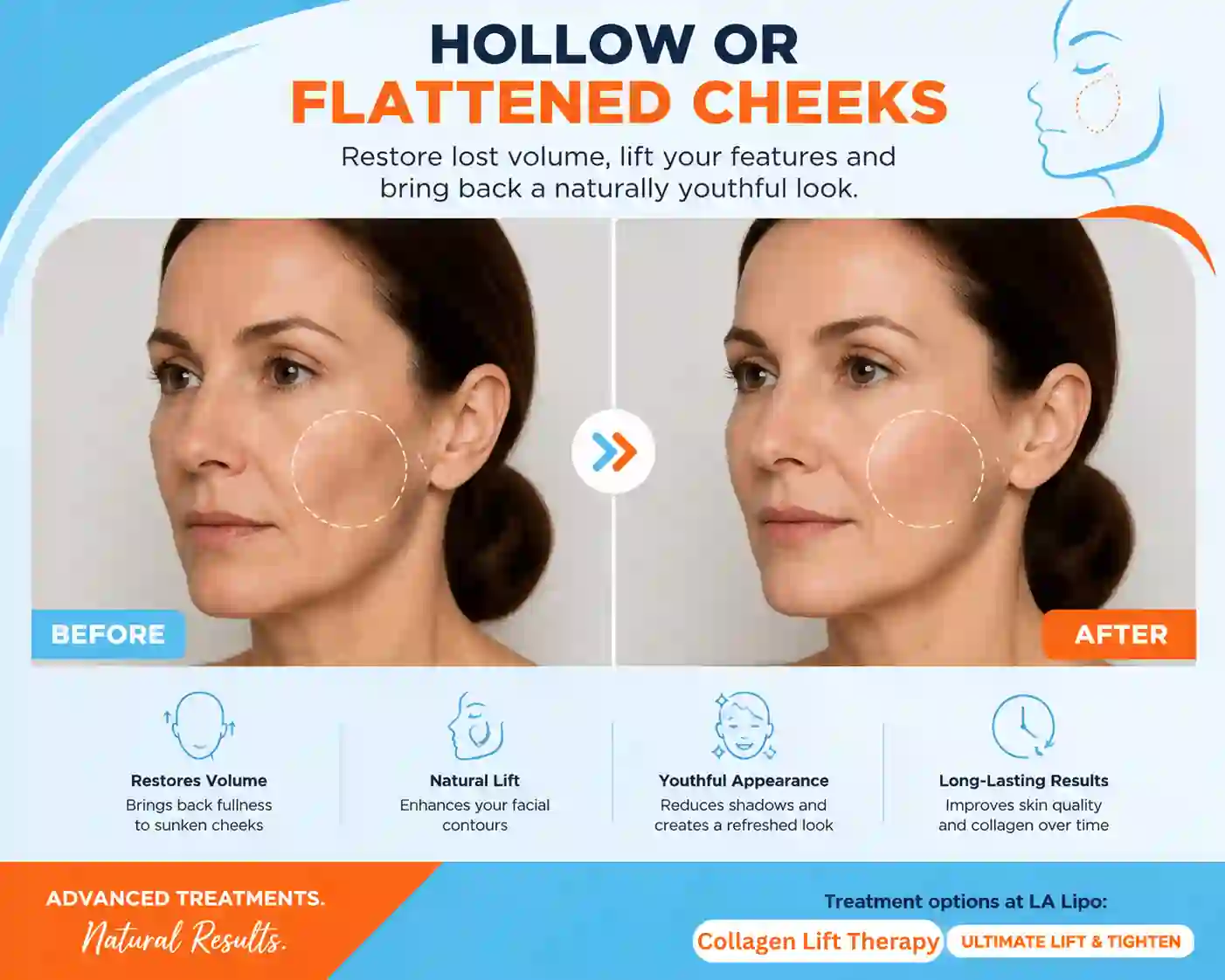 Sign #4: Hollow or Flattened Cheeks Wokingham