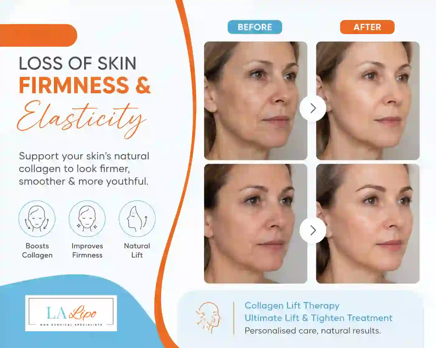 Sign #7: Loss of Skin Firmness and Elasticity Wokingham