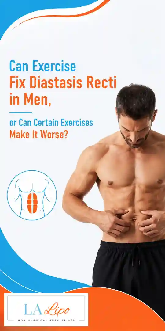 Can Exercise Fix Diastasis Recti in Men, or Can Certain Exercises Make It Worse Wokingham?